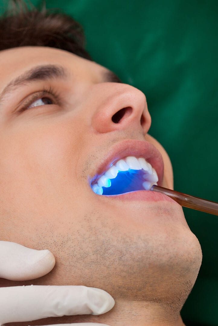 Laser-Dentistry-Dental-Technology-Endeavour-Hills-Dentist-Sunrise-Dental-Surgery
