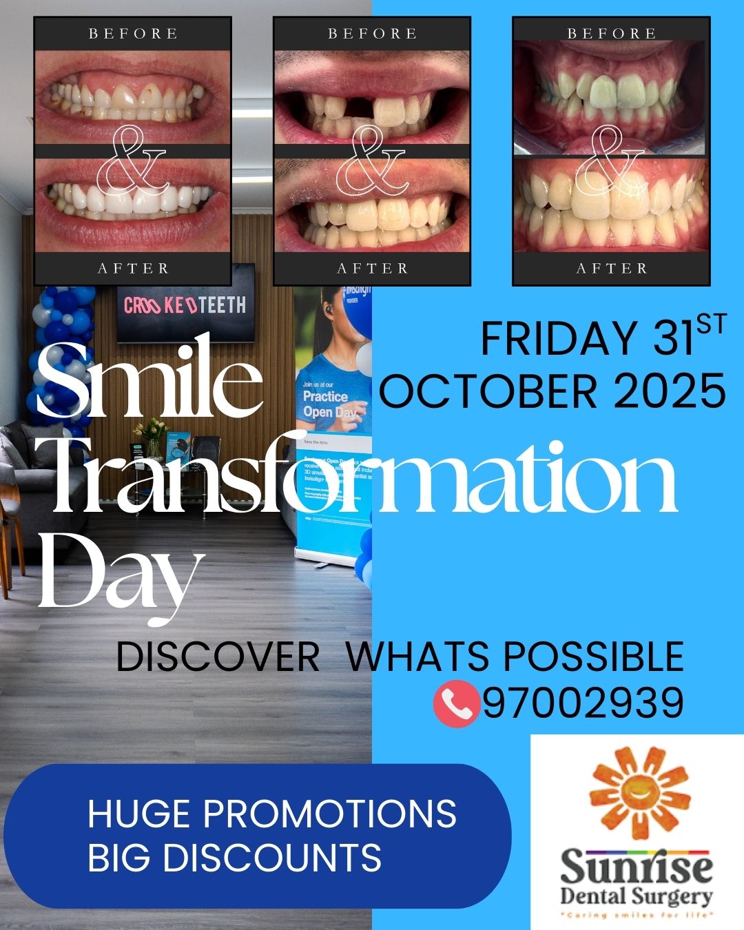 Smile Transforamtion Day